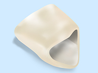 CAD/CAM冠