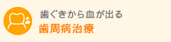 歯周病治療